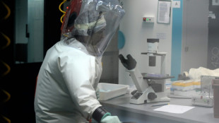 Ruanda inicia un ensayo clínico de tratamiento contra el virus de Marburgo