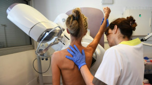 Mammograms should start at 40, says US task force