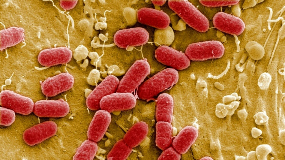 Harmful pollution boosting superbug 'silent pandemic'