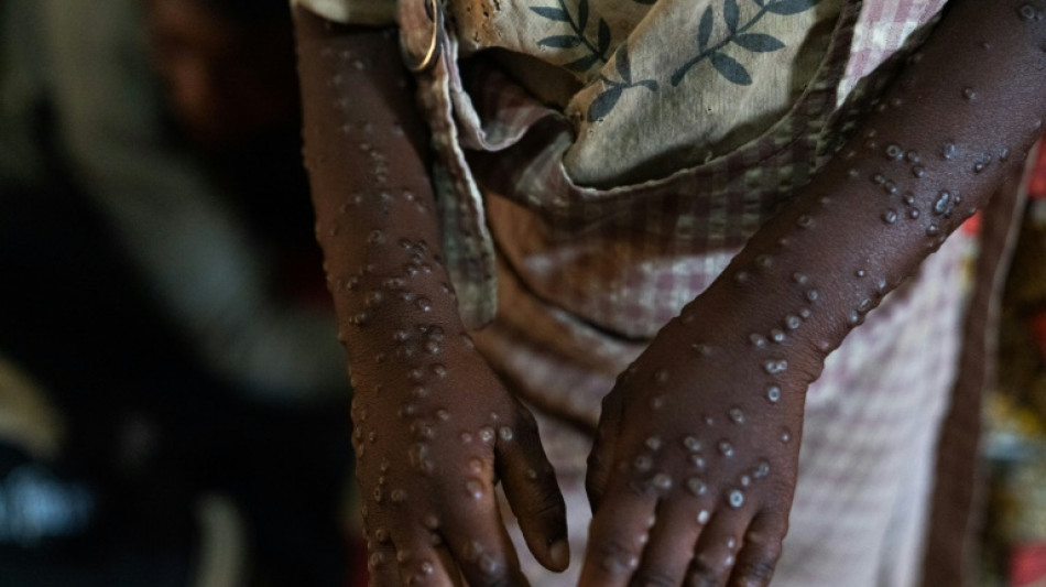 País mais afetado por surto de mpox, RD Congo começa campanha de vacinação