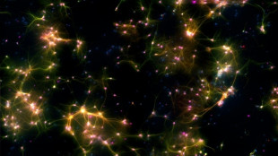 'Sentient' brain cells in dish learn to play video game: study