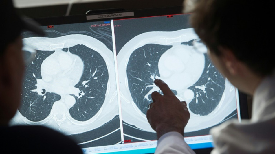 Higher cost of US cancer care doesn't improve survival rates: study