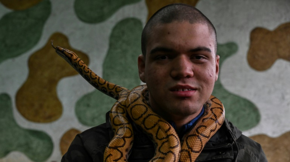 Snakes as therapy animals: reptiles help heal in Brazil