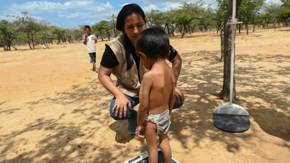 Hunger, thirst stunting Indigenous children in Colombian desert 