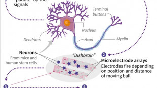 Brain cells in dish learn to play video game